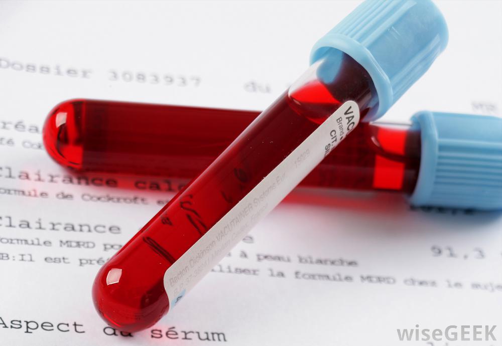 Laboratory Diagnostics and Blood work - Apple Valley Animal Hospital - Hendersonville, NC Laboratory Diagnostics and Blood work - Apple Valley Animal Hospital - Hendersonville, NC